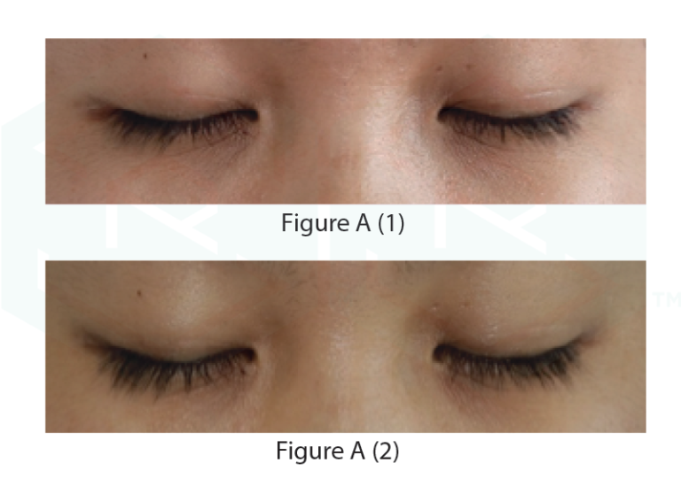 Eyelash Follicles Serum - Swiss Revitalisation